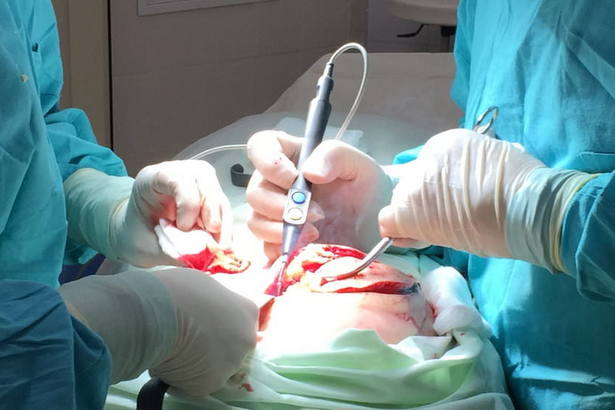 Зеленоградские хирурги удалили у пациента гигантскую атерому